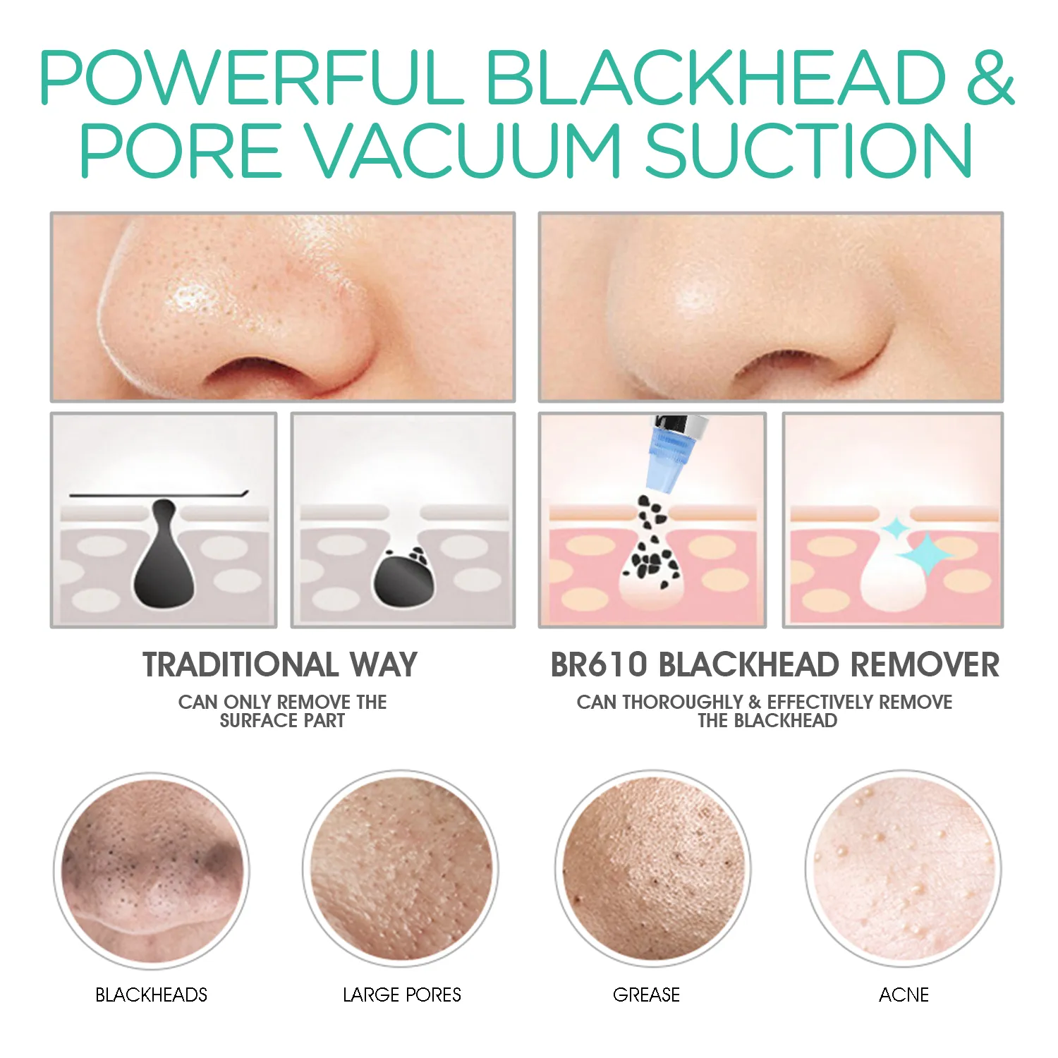 VOYOR blackhead vacuum pore cleanser BR610